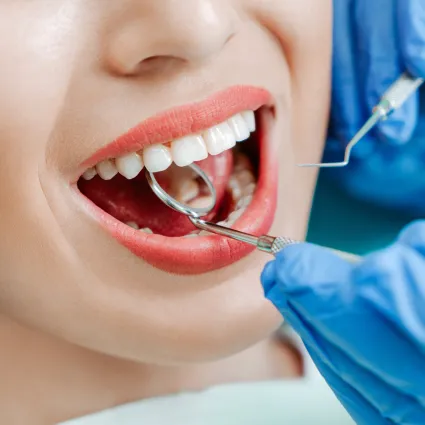 Tooth Extractions at Michael K. Bassiri DDS