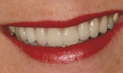 Great smile with beautiful teeth