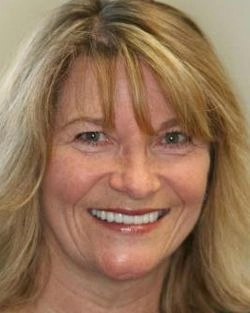 Full-face shot of woman with great teeth